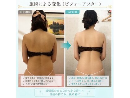 ケイビューティ(k-beauty)の写真
