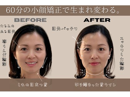 トワビー(towabii)の写真
