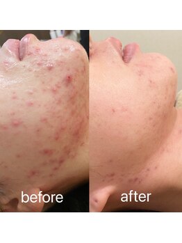 ブリエボ ニータ(BRILLER BONITA)/