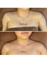 コガオテテ(Kogao tete)/お顔だけじゃありません！