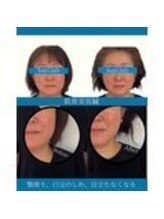 ハリラボ 仙台上杉店(hari Lab.)/【お客様の声】