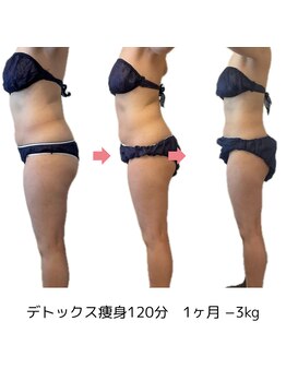 コーラル(Coral)/デトックス痩身(40代施術結果)