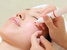 脱毛 痩身ぴゅあら