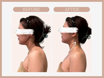 スリムライン 秋田店(The Slim Line)/before→after