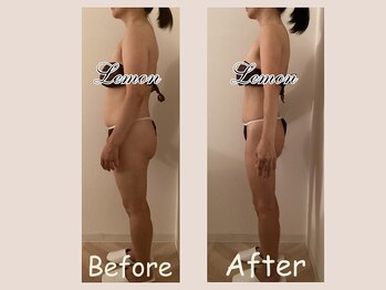 レモン(Lemon)/ビフォーアフター