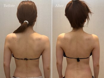 ラシュール(Rassure)/ボディメニューも人気