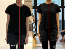 エボ パーソナルトレーニングジム 泉店(E.V.O)/歪み・不調の改善