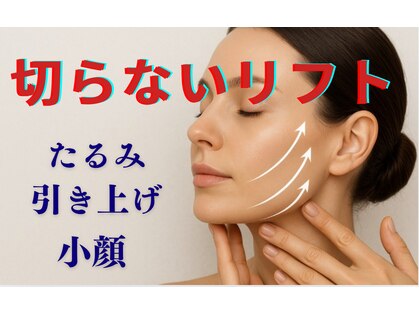 ルナ(Luna)の写真