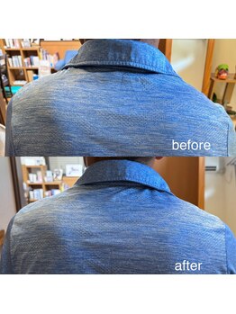 カイロプラクティック ネクサス/側湾と頭痛を撃退☆