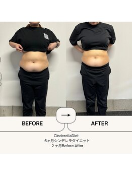 オーシャン整骨院(OCEAN整骨院)/6ヶ月コース