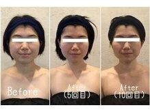 小顔フェイスラボ 岡崎店(小顔 Face Labo.)の雰囲気（5回目からは無料で小顔矯正をプレゼント！骨格から小顔に改善♪）