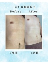 エデン つくば店(EDEN)/メンズ全身脱毛
