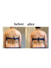 ビーバイビー(BBYB)/筋膜リリース背中