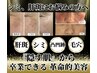 【隠す肌から卒業！】最先端の次世代シミケア 全顔30分取り放題