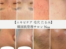 ノア 新宿(Noa)