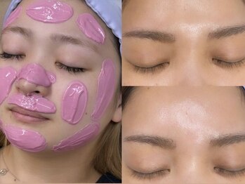 ルシエルプラス(le ciel+)の写真/ワックス×リジュランで本来の美しさに！PDRNアンプル導入◇ダウンタイム無しで極上ハリ艶を叶える♪