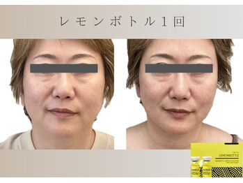 フロックス(Phlox)