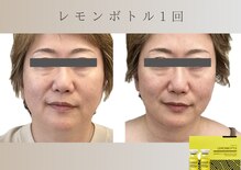 フロックス(Phlox)