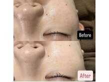 ハイコガオ 中崎町店(HIKOGAO)/ララピール