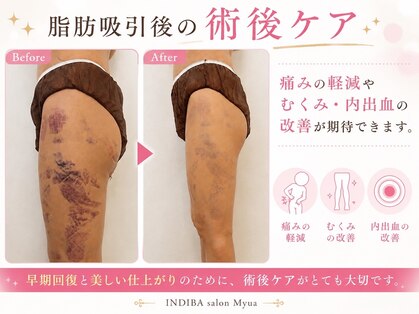 ミュア 難波大国町(Myua)の写真