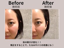エヌ(N)/目の開きも大幅改善♪ 恵比寿