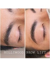 ヨリソイ(yorisoi)/HBL