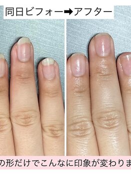 桃の木 吉祥寺店/爪の形で印象変わります
