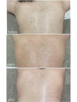 モンクラッシー(Mon classy)/