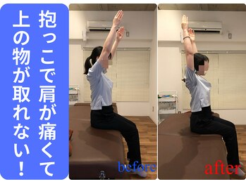 広島ミライエ整体院(広島MIRAIE整体院)/抱っこで肩と腕のしいんどさ