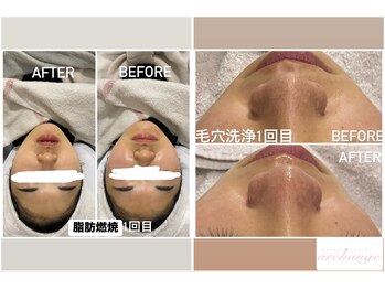 アルカンジュ(archange)