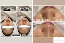 アルカンジュ(archange)