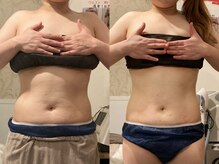 プライベートエステティックサロン クール(Coeur)の雰囲気（【痩身×パーソナルトレーニング】短期間で効率よく結果が出る！）