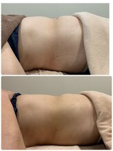 ディアウーマン(Dear Woman)/脂肪分解【スリミラボディ】