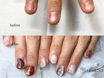 ナンバーアンドスリーサン(No&33)/【深爪】ケア・ジェルネイル