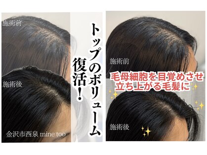 マイントゥー(mine too)の写真