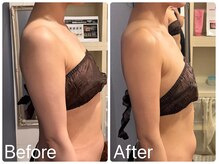 サロンドフェイス(Salon de Faith)/ブライダル10回