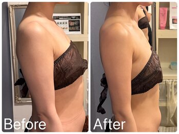 サロンドフェイス(Salon de Faith)/ブライダル10回