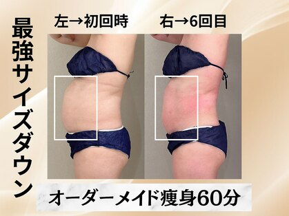 イヨヨ(iyoyo)の写真