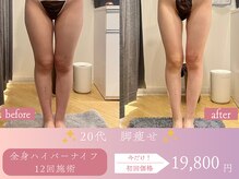 スリムプロ 天王寺店(Slimpro)/下半身ダイエット