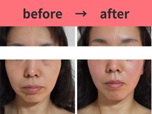 アールフェイシャル 郡山店(Rr.FACIAL)