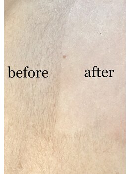 ラフ(Laugh)/ワックス効果