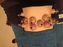 ふぁん/腸マッサージ25分+吸玉25分