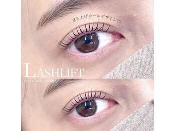 ビーティー(bT)/