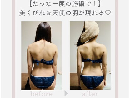  ジュエル(JEWEL)の写真