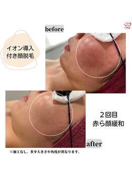 オリオンドットエスツー(Orion.S2)/【Before→After】