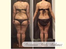 美プレミアム 越谷店/５、施術結果