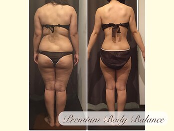 美プレミアム 越谷店/５、施術結果