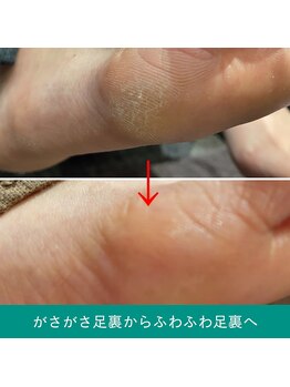地爪ケアクリニックサロン 仙台/【足爪ベーシックケア】