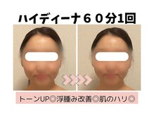 ヨサパーク ハナ(YOSA PARK hana)/