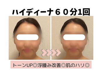 ヨサパーク ハナ(YOSA PARK hana)/